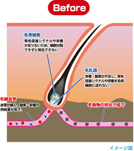 血管拡張Before