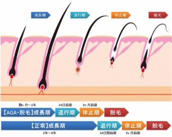 agaの頭皮サイクル