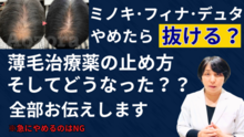 ミノキシジルやめたい