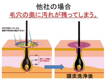 大手サロンの頭皮洗浄法